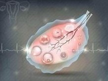 成都做试管婴儿的具体步骤是什么